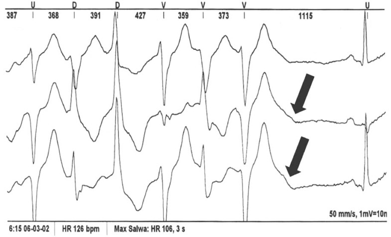 Fig. (2)