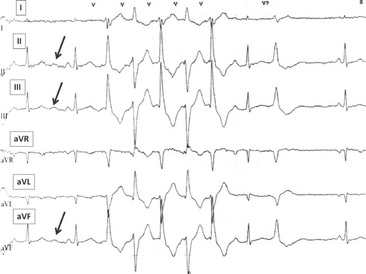 Fig. (4)