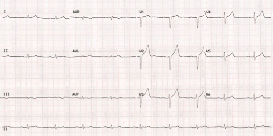 Fig 2.