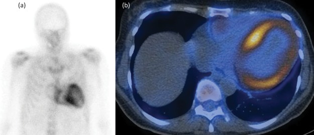 Fig 5.