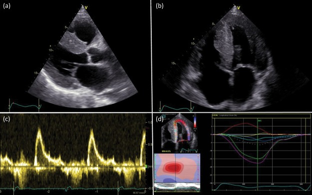 Fig 3.