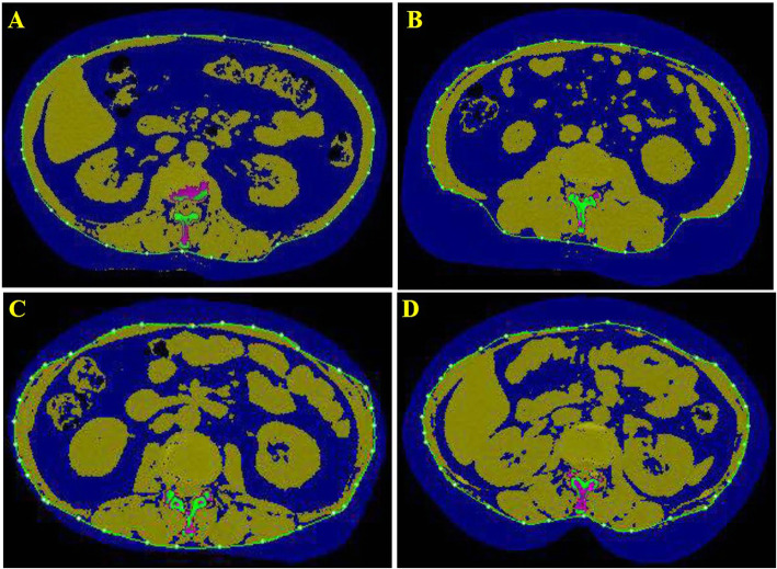 Fig. 1