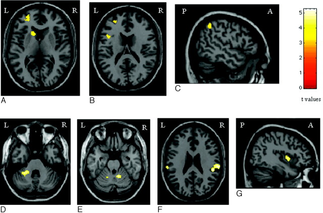 Fig 3.