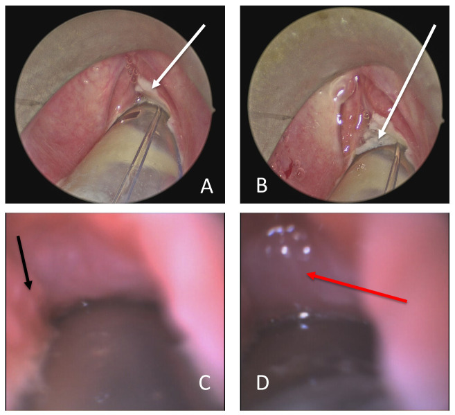 Figure 4. 