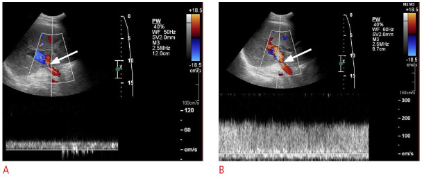 Fig. 26.