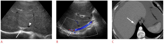 Fig. 22.