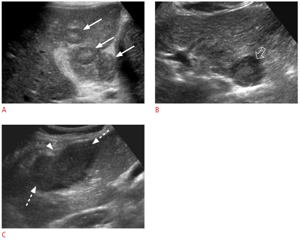 Fig. 15.