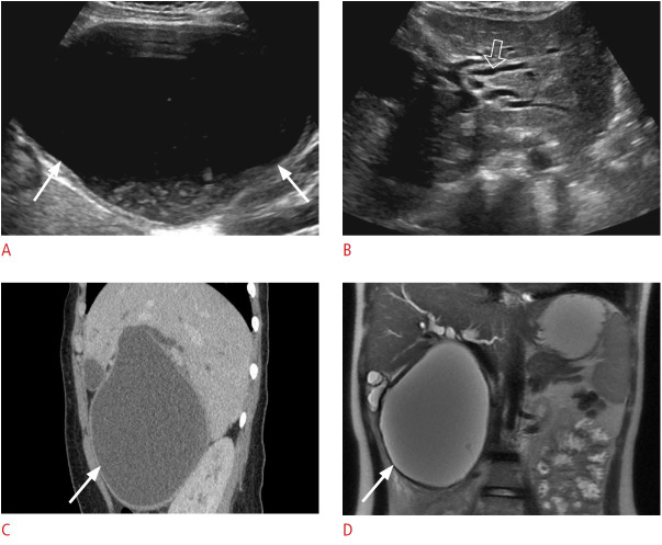 Fig. 11.