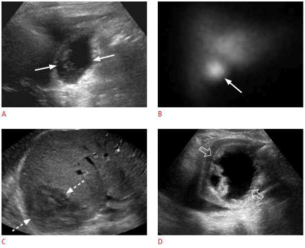 Fig. 17.