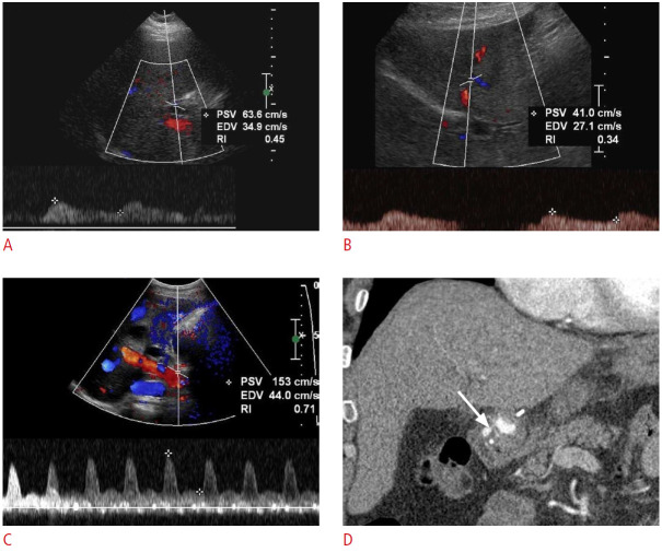 Fig. 24.