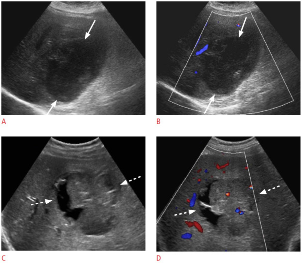 Fig. 16.