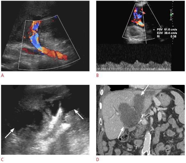 Fig. 23.