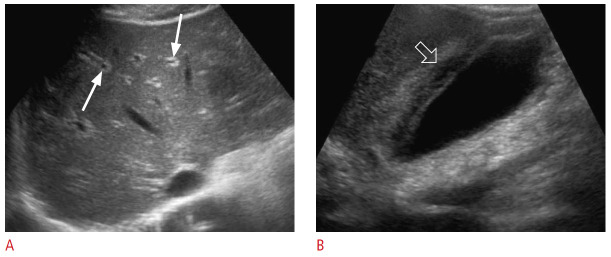 Fig. 13.