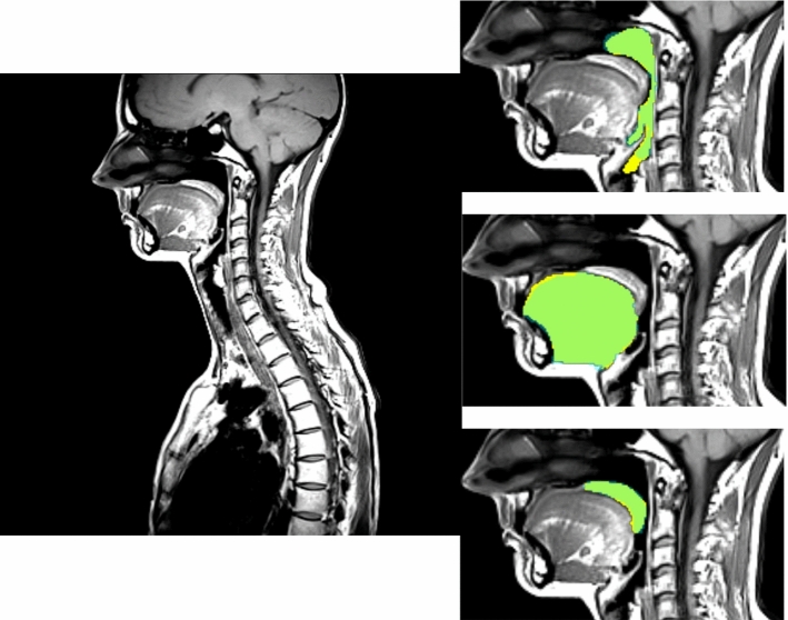 Fig. 5