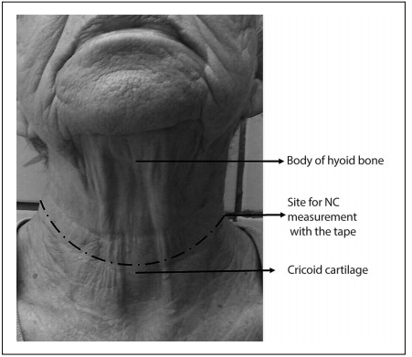 Figure 1: