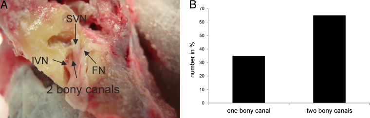 FIG 2