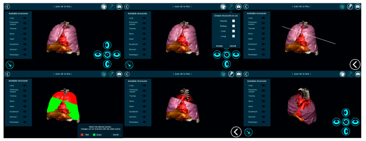 Figure 19