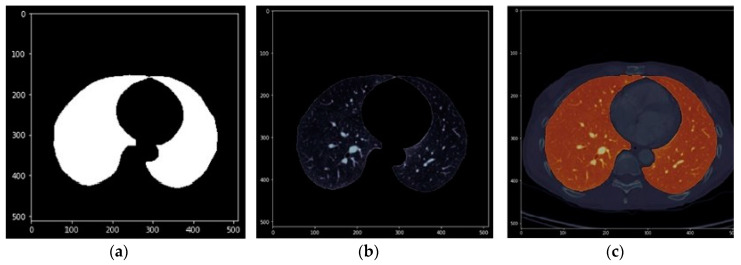 Figure 11