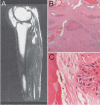 Fig. 2A–C