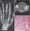 Fig. 4A–C