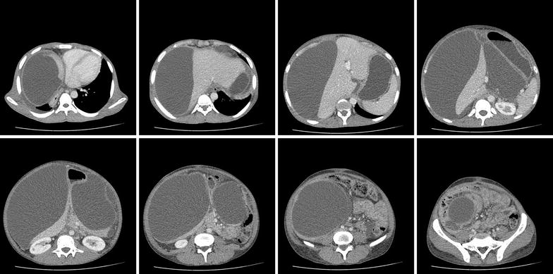 Fig. 1