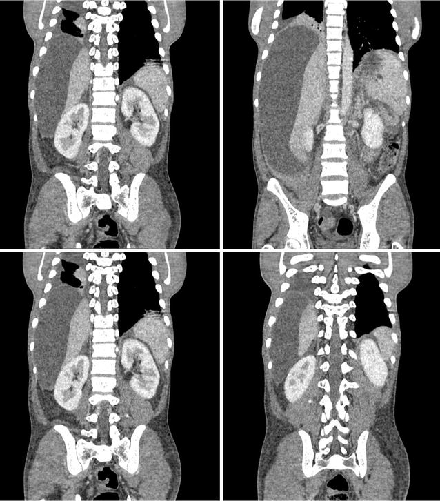 Fig. 2