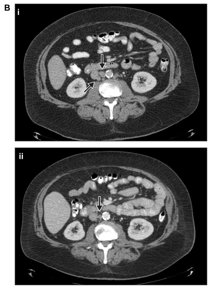 Figure 2B