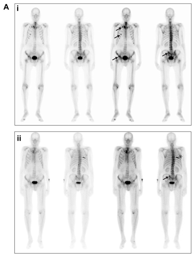 Figure 2A