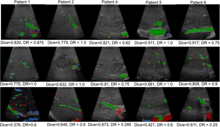 Fig. 3