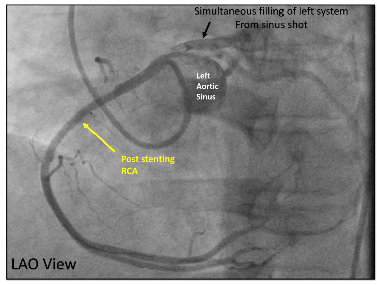 Figure 24