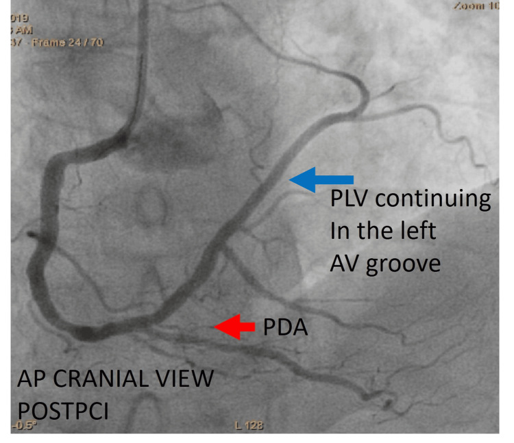 Figure 6