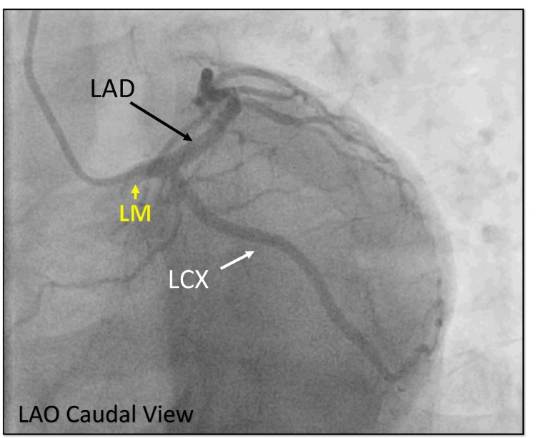 Figure 18