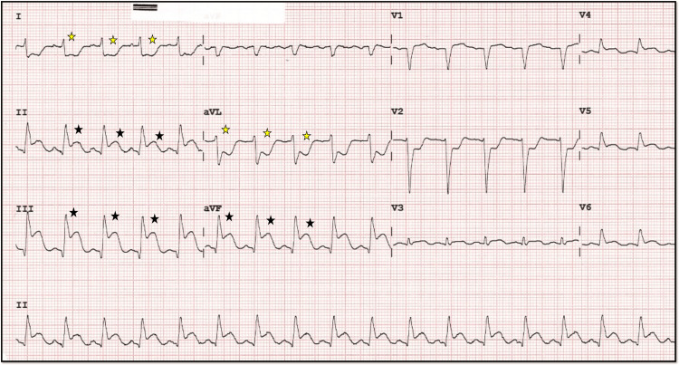 Figure 17