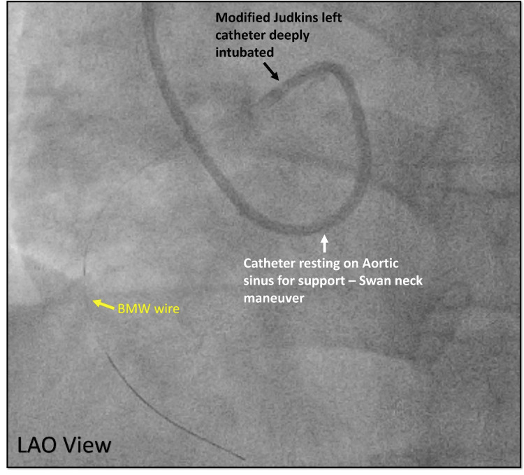 Figure 21