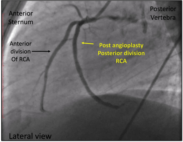 Figure 15