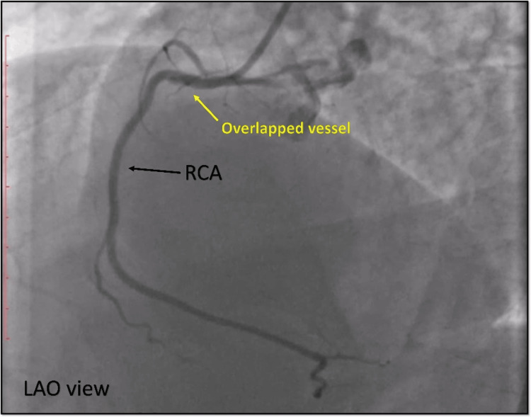 Figure 10