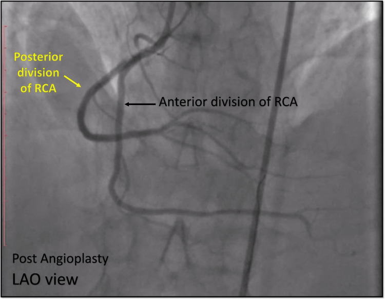 Figure 14