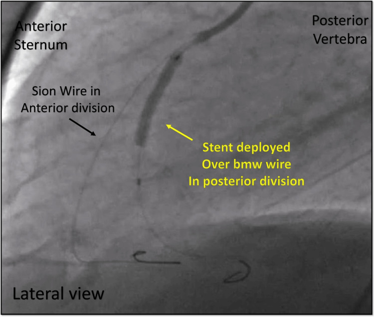 Figure 13