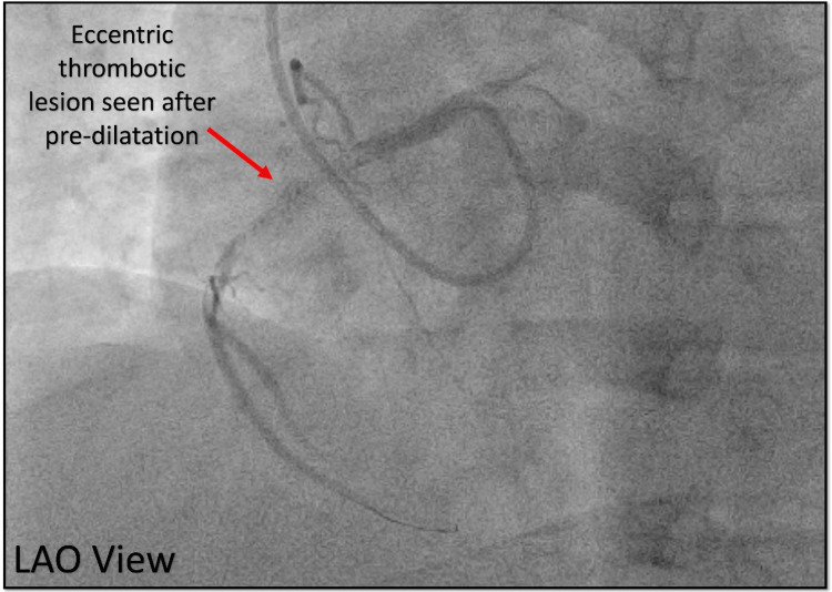 Figure 22