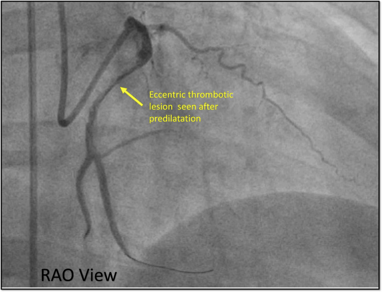 Figure 23