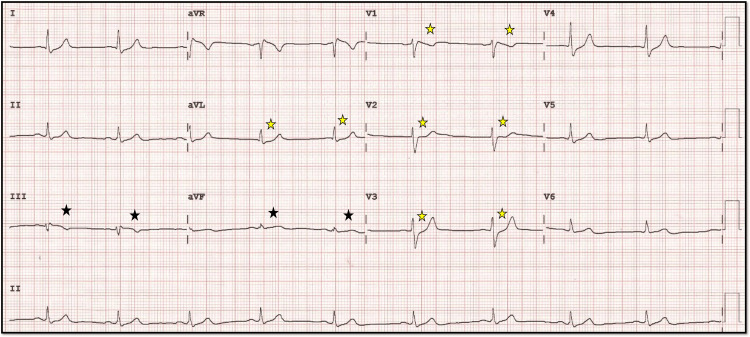 Figure 16