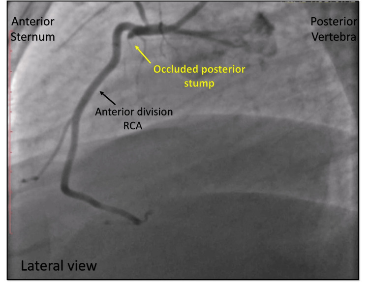 Figure 12