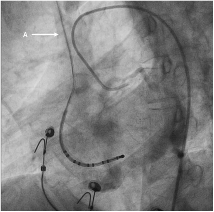 Fig. 4