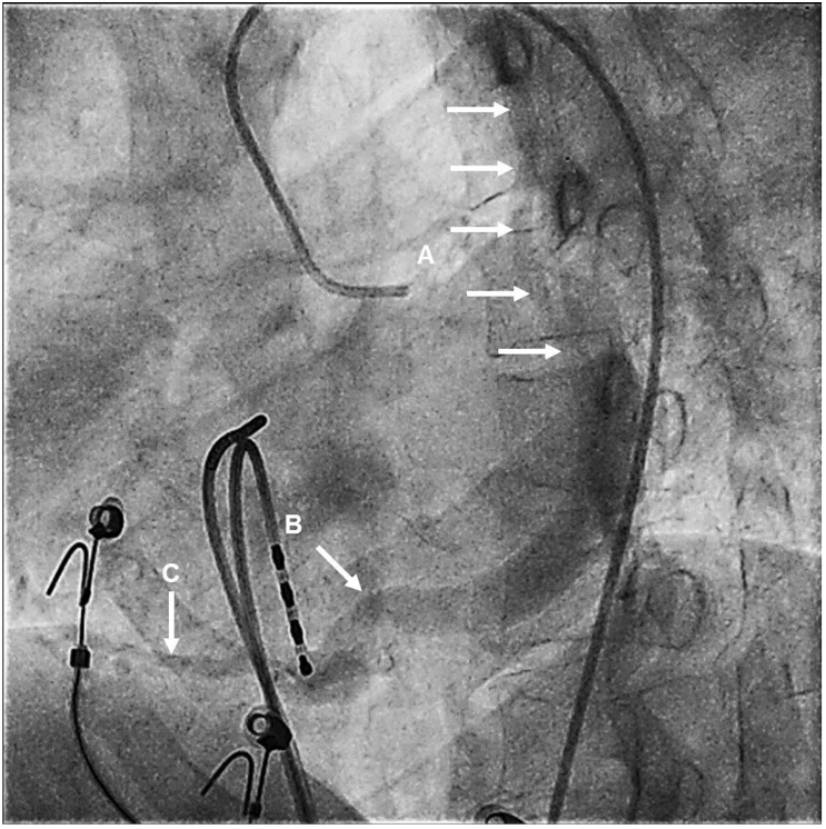 Fig. 2