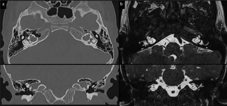 Figure 1. a, b