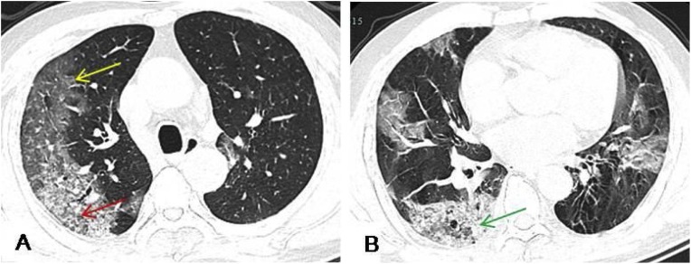 Fig. 4