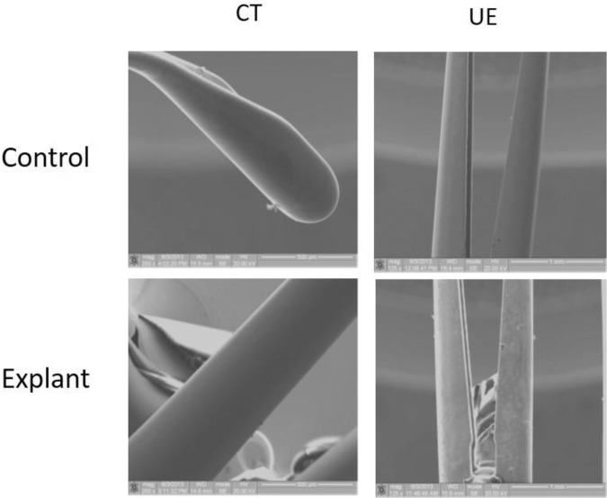 The UroLift implant: mechanism behind rapid and durable relief from ...