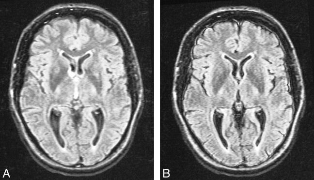 fig 3.