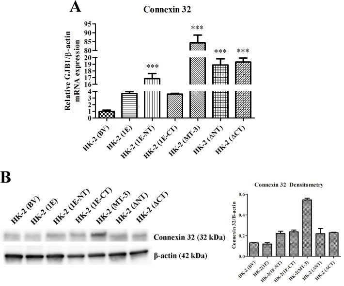 Fig 11