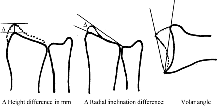 Fig. 3